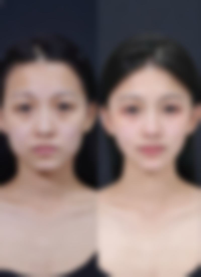 佛山亚韩整形美容门诊部医院技术好不好?