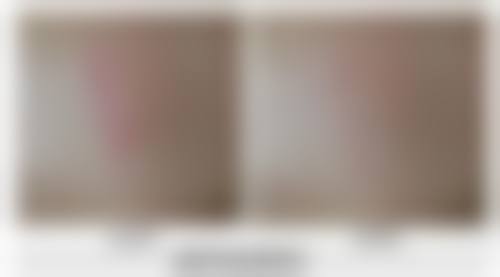 武汉张小熊医疗美容诊所电话号码及预约方法