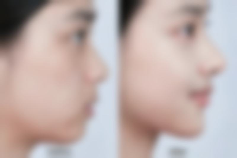 西安微之光医疗美容诊所硬件设备精良!