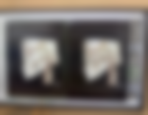 武汉伊丽莎白整形医院收费标准参考