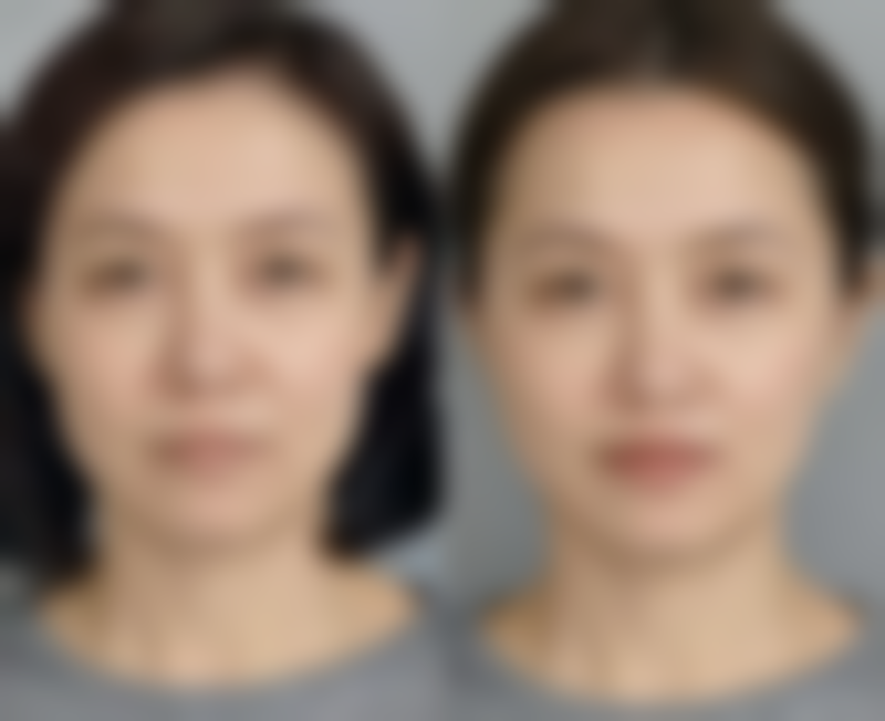 大同清木专精整形机构医院技术好不好?