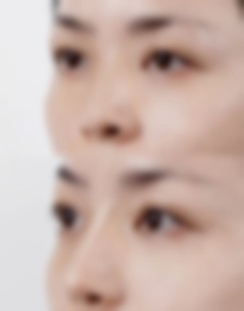 郑州诺亚医疗美容门诊部口碑如何?