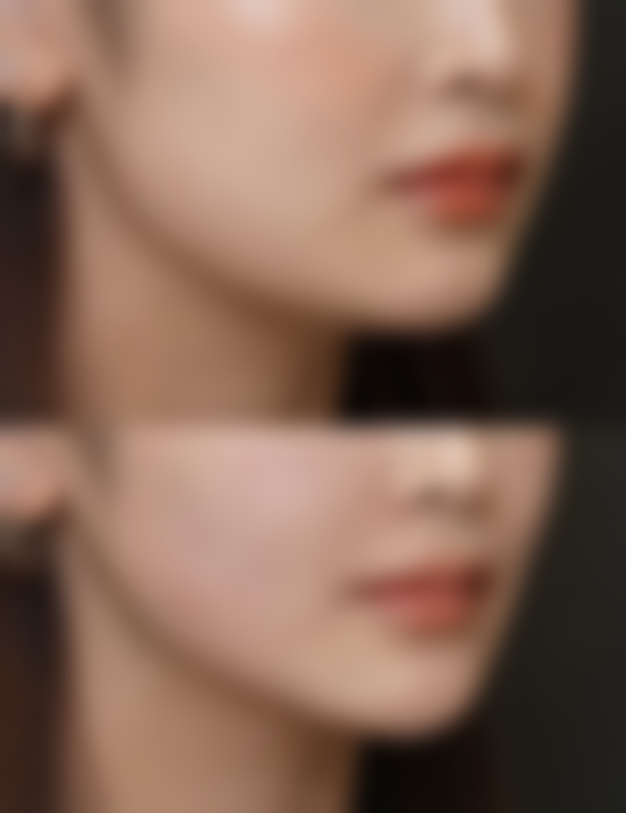 如何降低隆胸的副作用