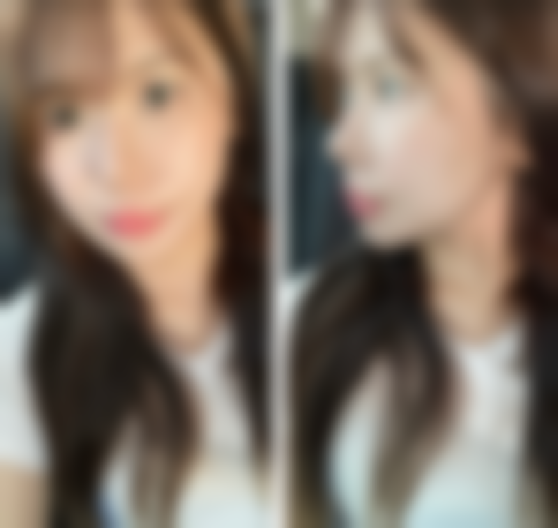 西安欣奕整形医疗美容诊所硬件设备精良！