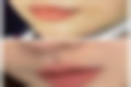 本溪王小明医疗美容诊所王小明医生技术好不好？