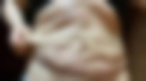 福州爱美尔整形医院周金超医生技术好不好？