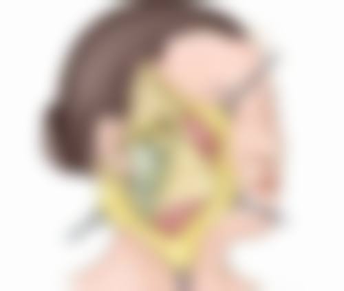 种植头发是怎么操作？涵盖术前到术后六环节含设计、提取、植入和护理要点