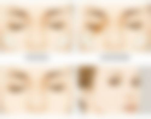 威海兰积医疗美容诊所硬件设备精良！