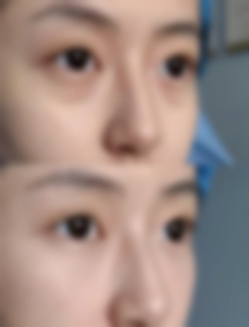 韩国Liting整形外科李相焕医生技术好不好？