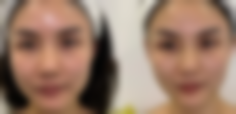 总结——合肥经开区好肤恒整形外科门诊部怎么样？