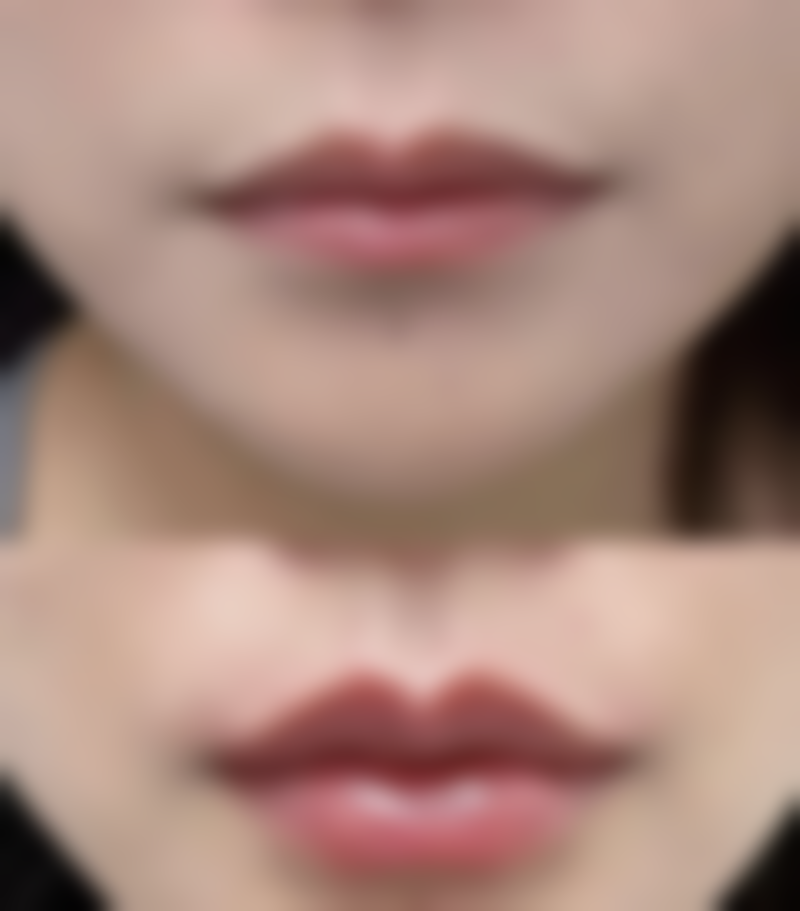 长沙爱馨整形医院贺珊婷从医荣誉