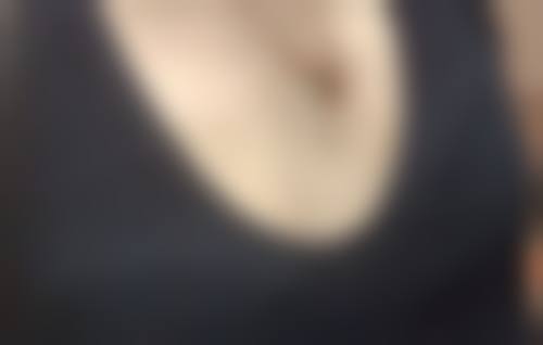 影响抽脂手术成效的因素