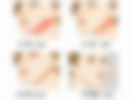 总结——福州爱美尔整形医院郑欣医生怎么样?