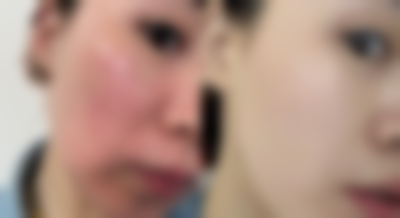 重庆精美医疗美容门诊部苟正华医生口碑评价如何？