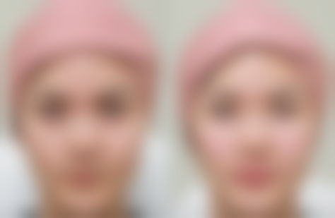 梦想整形外科口碑如何？