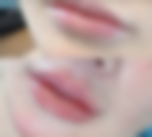 抽脂手术的成效体现