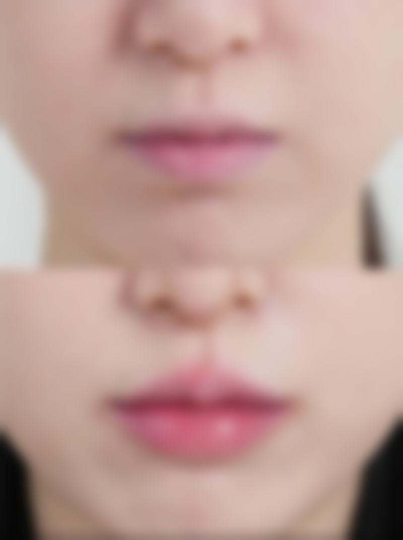 洛阳班爱荣医疗整形美容诊所收费标准参考