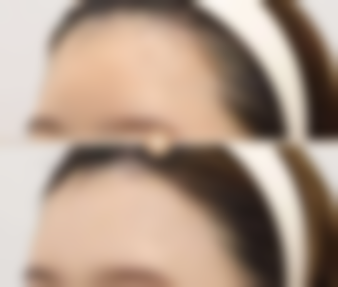 广州天河海峡整形医疗门诊部口碑如何?