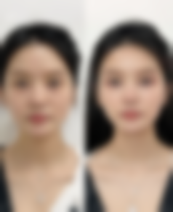 成都碧莲盛医疗整形美容医院医院技术好不好？