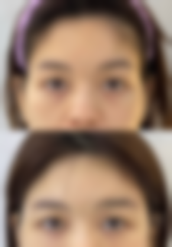 广州军颐医院整形美容中 心官小书医生技术好不好？