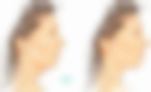 广州军颐医院整形美容中 心崔菲菲医生口碑评价如何?