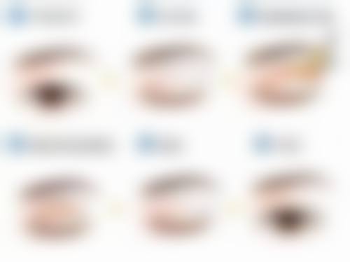 张立天医生的下颌角手术技术