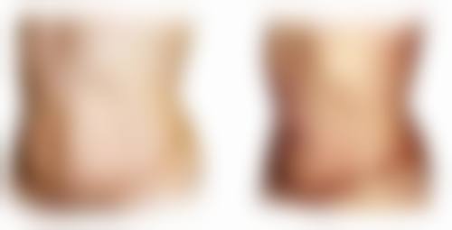 宜春天泽皮肤美容整形医院易军学医生技术好不好?