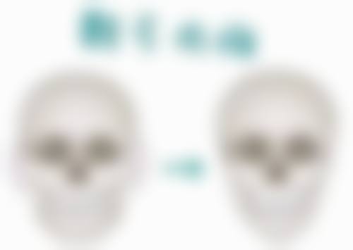 郑东精蝶医疗美容诊所医院技术好不好？