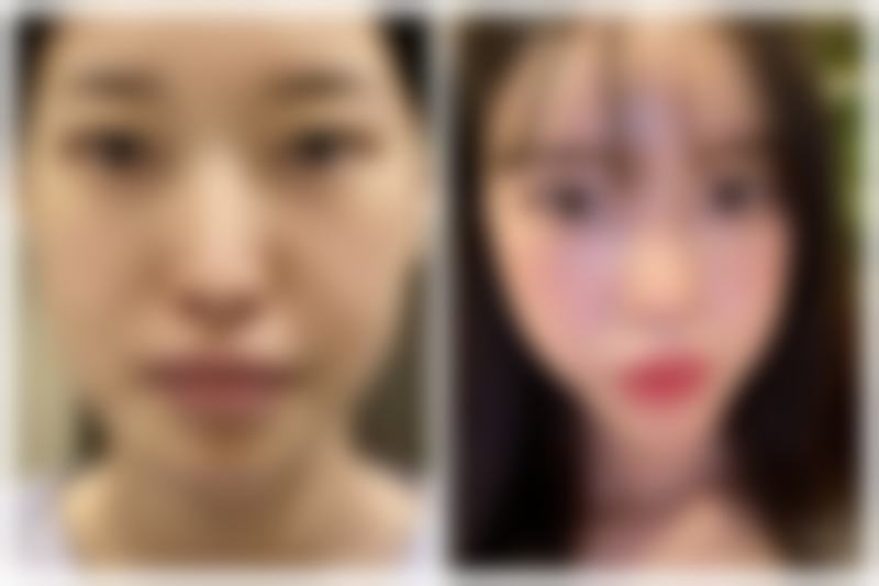 武汉海峡唯美整形医疗美容门诊部医院技术好不好?