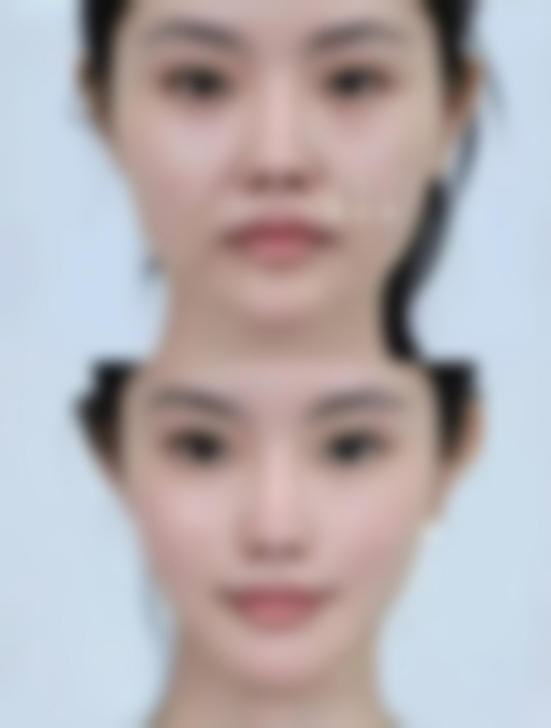 总结——武汉海峡唯美整形医疗美容门诊部怎么样?