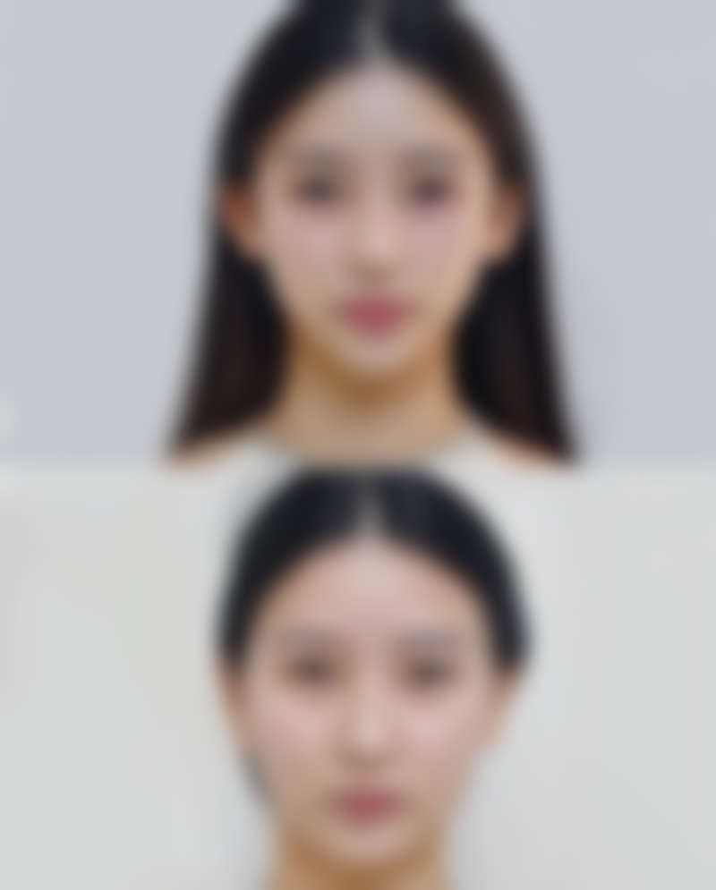 深圳星禾医疗美容门诊部卢钟勋医生口碑评价如何？