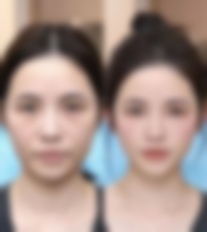 昆明芯美昕医疗美容门诊部收费标准参考