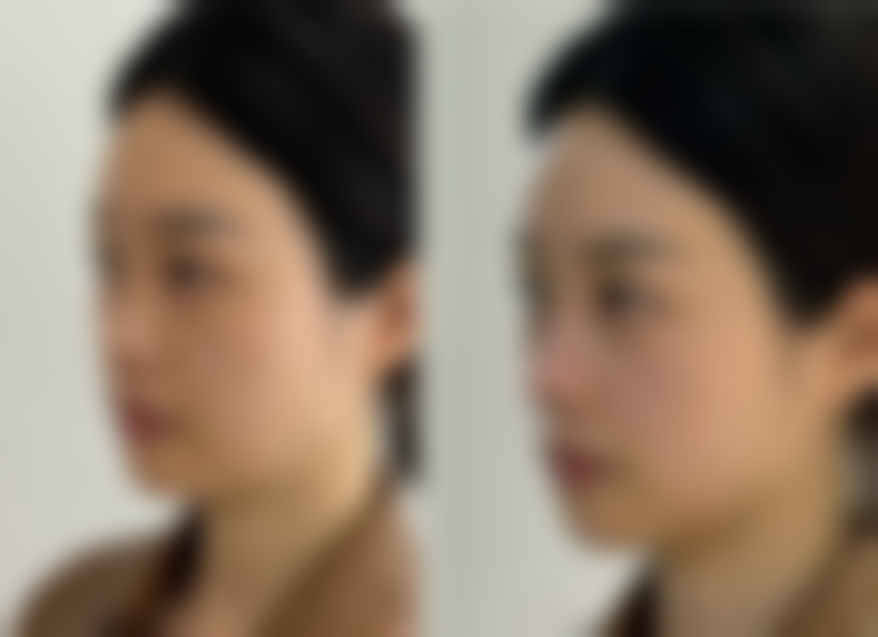 国内人民解放军第二0二医院美容整形中 心营业时间