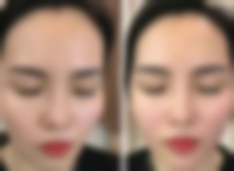 总结——郑东精蝶医疗美容诊所怎么样？