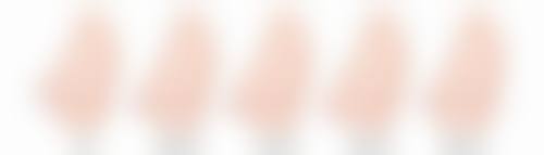 假体移位带来的危害有多大