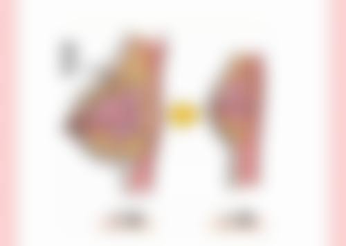 皮肤起条状波纹的危害及后遗症