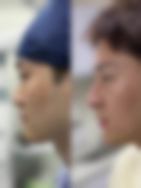 总结——广州军颐医院整形美容中 心曾晶圆医生怎么样?