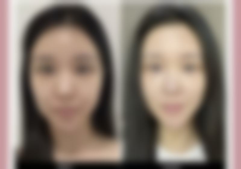 甘肃颜艺美医疗美容诊所收费标准参考