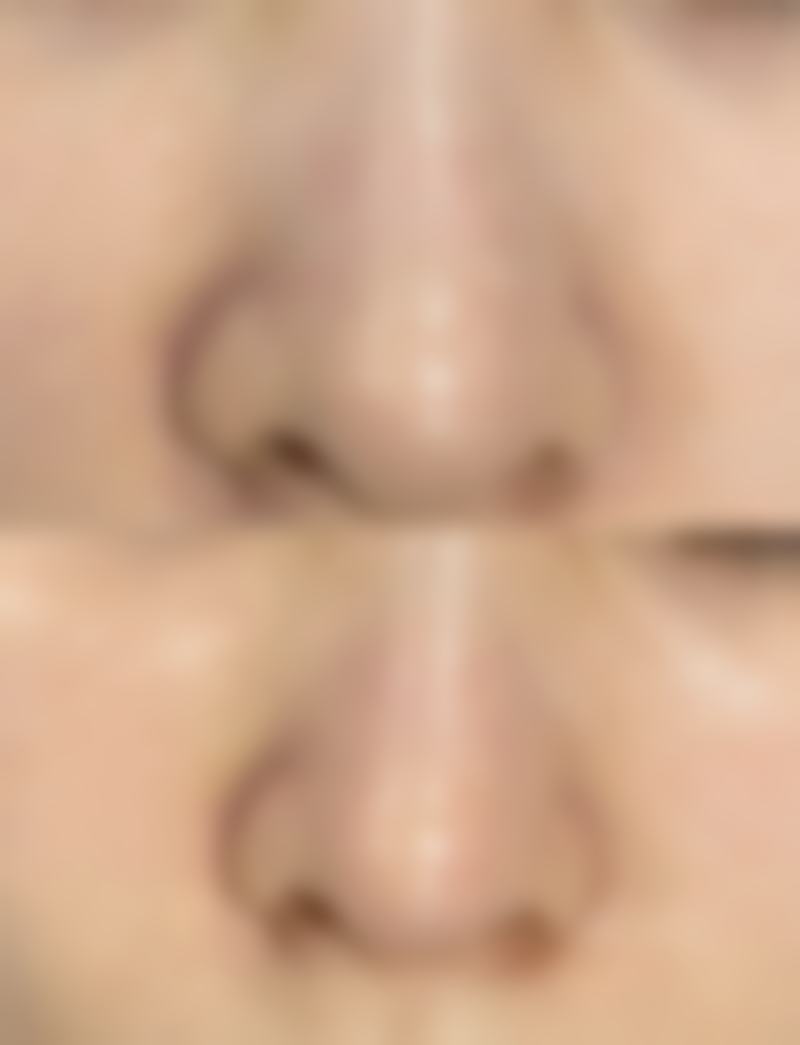 本溪王小明医疗美容诊所王小明医生技术好不好?