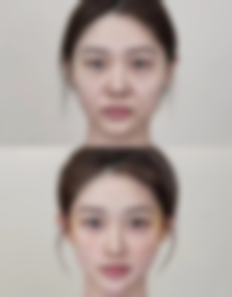 女人小阴唇缩小的常见生理性原因有哪些