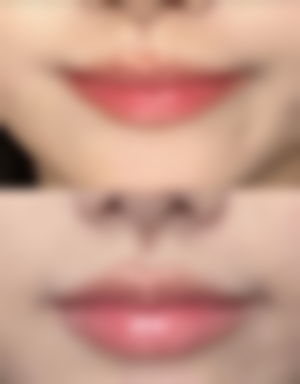 注射隆胸手术后该如何护理