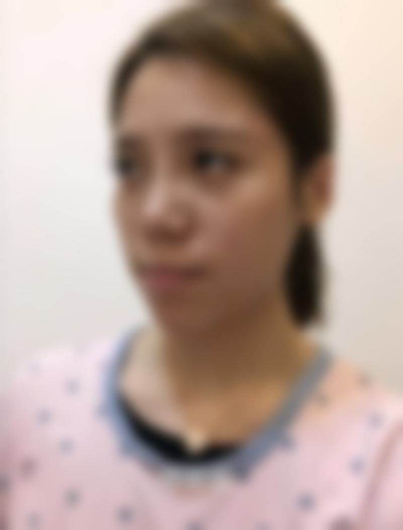 广东韩妃医疗美容医院鼻综合，整体评价如何？