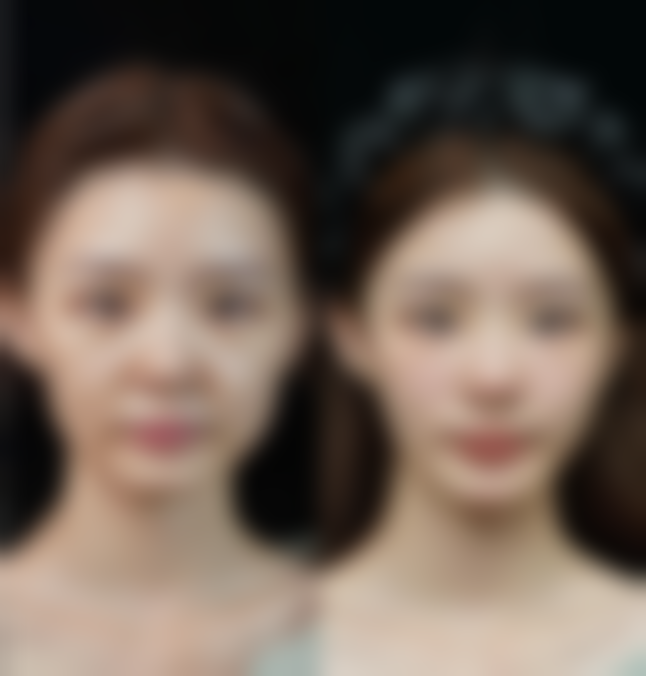 盐城大丰维多利亚整形医院医院技术好不好？