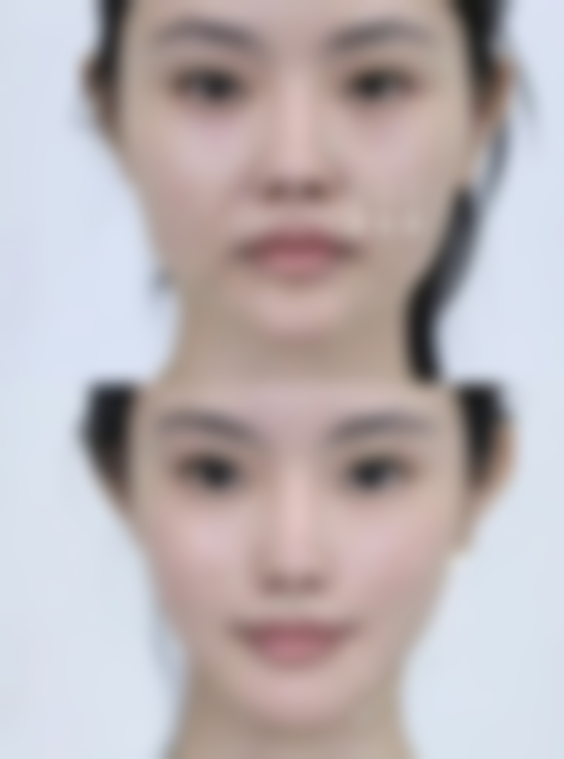 日常护理改善眼袋小妙招