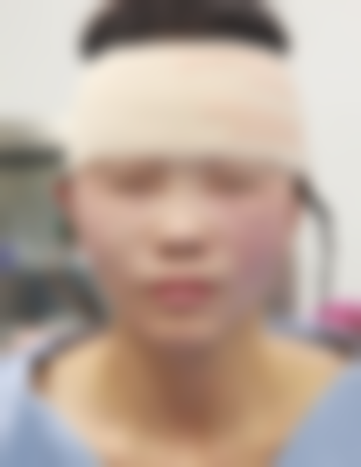 北京加减美医疗美容门诊部的组织提拉面部紧致项目,治疗过程是怎样的?