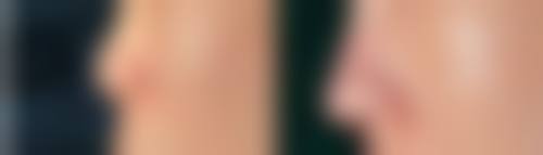 DB 整形外科收费标准参考