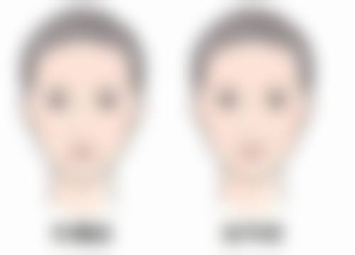 总结——珠海盈美医疗美容门诊部怎么样？