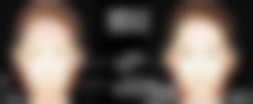 深圳晟丽瀞一博颜整形医院收费标准参考