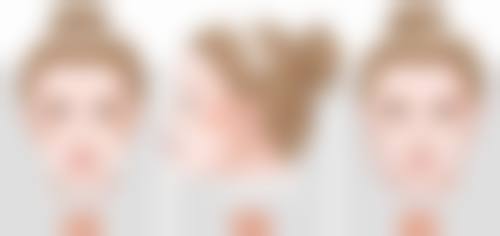 瘦脸针五天有效果吗？多数人无明显效果，术后饮食及医美医院选择也有讲究