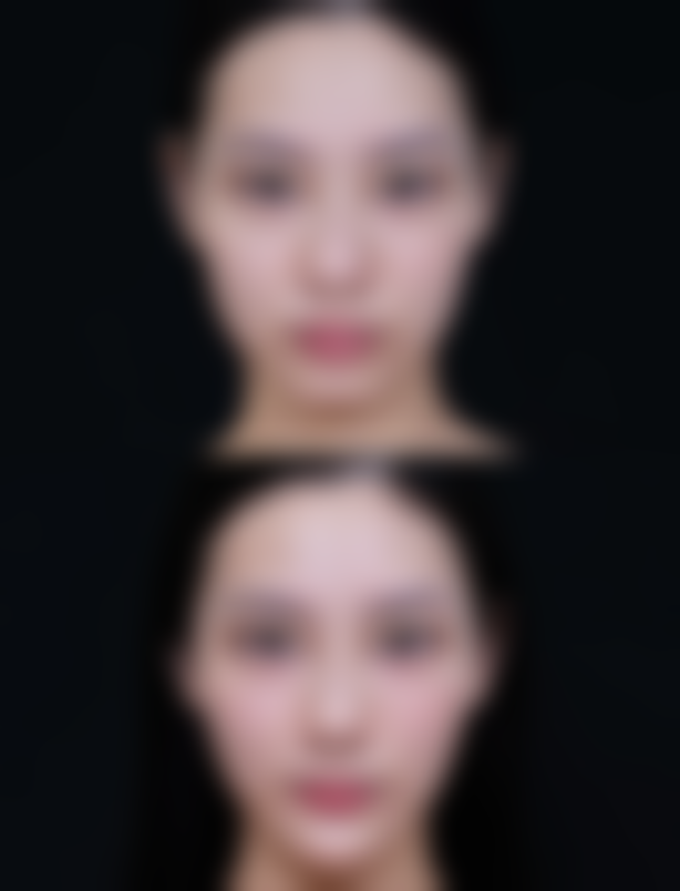 杭州韩树奈瑞儿医疗美容诊所口碑如何?